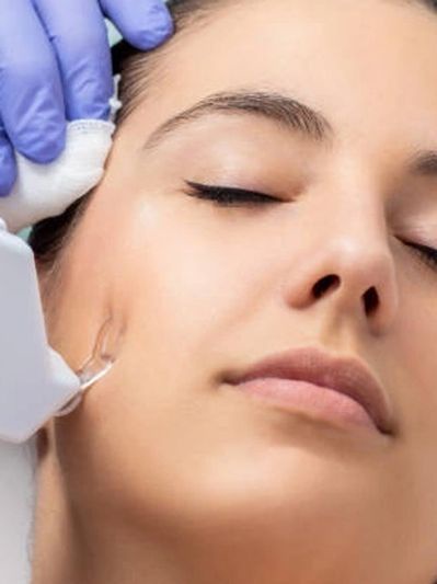 Understanding Mesotherapy Facial Skin Treatment