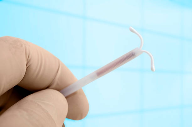 How much does an intrauterine device (IUD) cost?