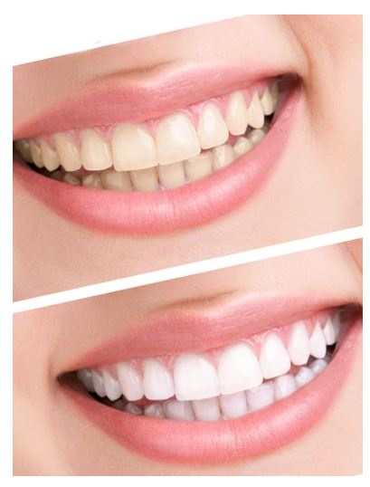 Keep the whiteness of the teeth intact, which too easily
