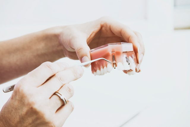 Emergency Dentist in Cardiff - Expert Care for Fast and Effective Dentistry