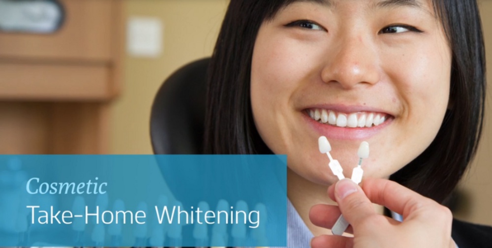 How can in-office professional teeth whitening procedures be helpful for you?