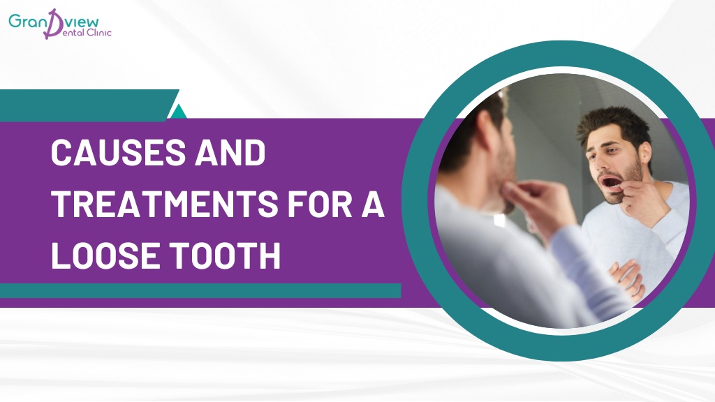 Causes and treatments for a loose tooth