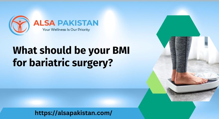 What should be your BMI for bariatric surgery?