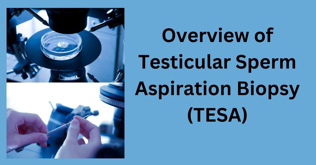 An Overview of Testicular Sperm Aspiration Biopsy with IVF treatment in Rwanda