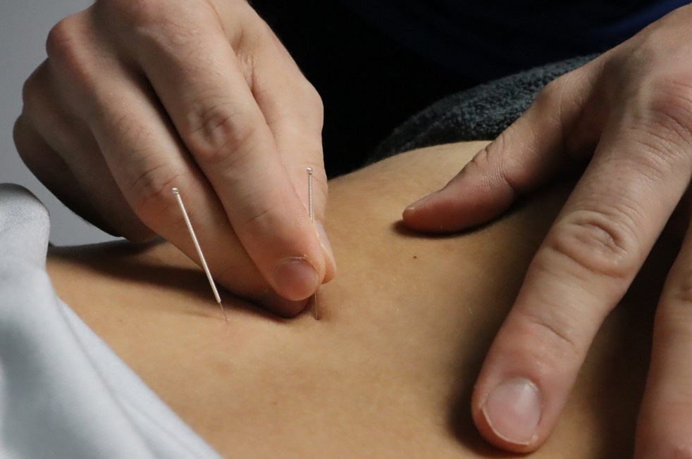 Dry Needling Therapy, Blood Flow Restriction, & Cupping: Does It Work for Athletes?