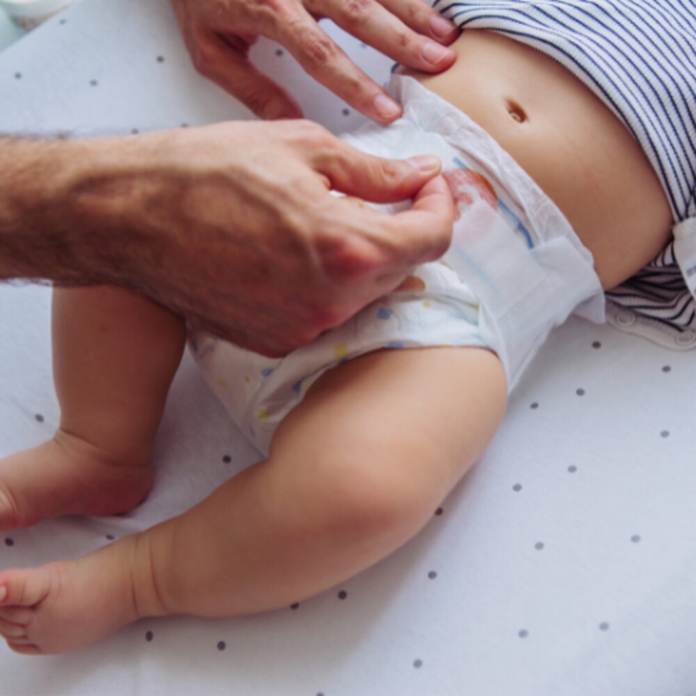 5 Effective Remedies to Treat Diaper Rash