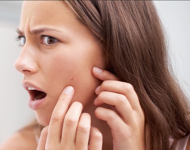 Find out All You Need to Know about Acne & Acne Anti-Aging Treatment