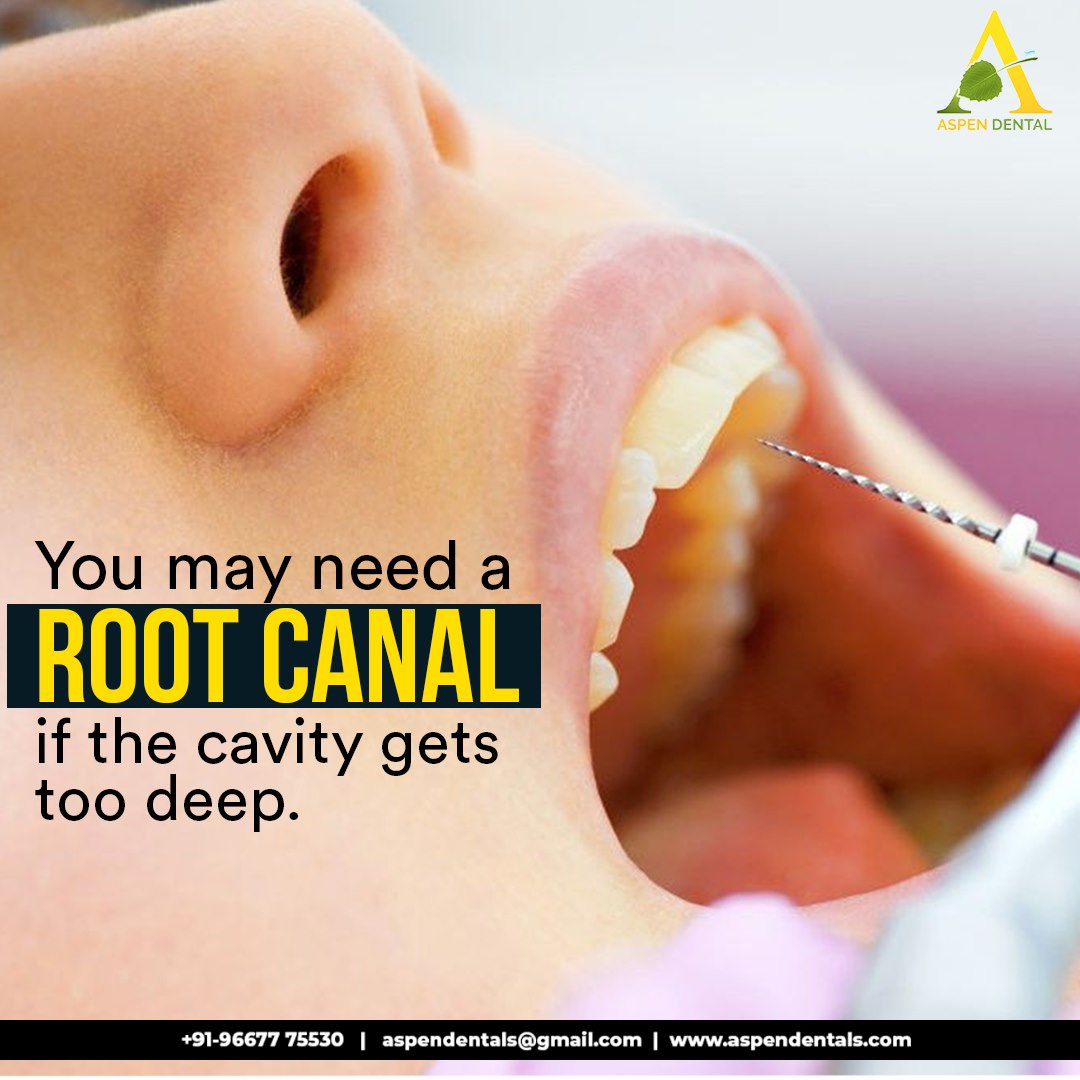 Root Canal For Kids: Is It Necessary?