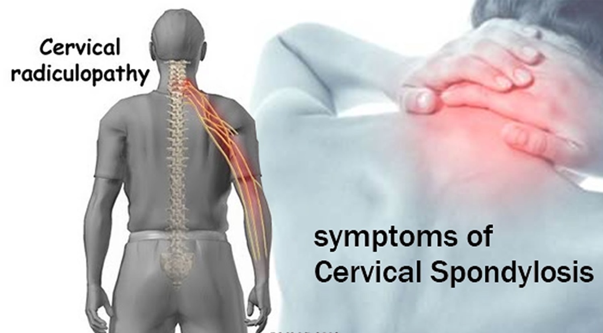 Treat Spondylosis From The Best Treatments Of Mahim!