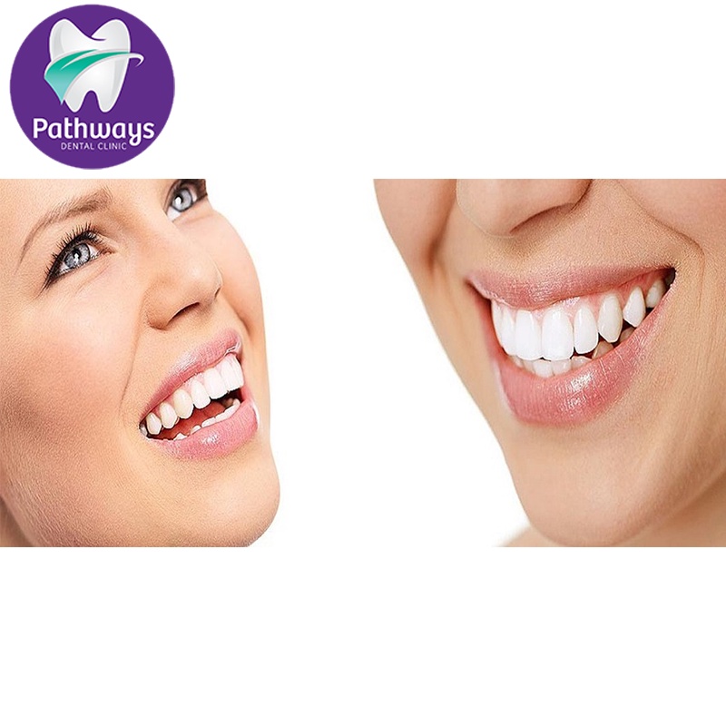 What is the importance of teeth whitening for oral health?