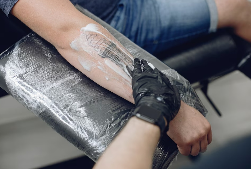 The Latest Trends and Technologies in Tattoo Removal in Dallas TX