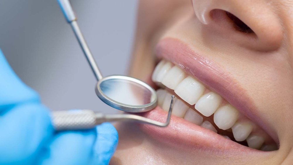 Discover the Best Dentist in Guelph for Safe and Effective Dental Bridges