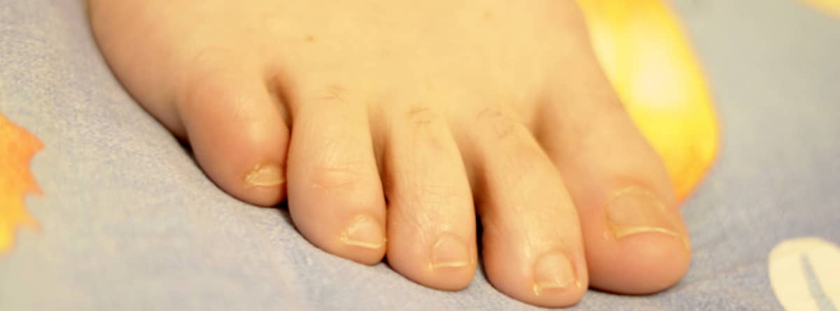 The Surprising Reasons for Yellow Feet and How to Fix Them!