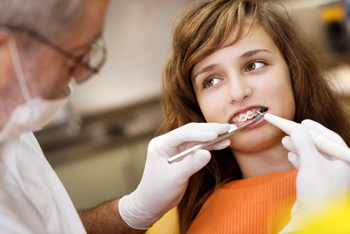 Why Should I Get Braces? Understanding the Reasons for Orthodontic Treatment