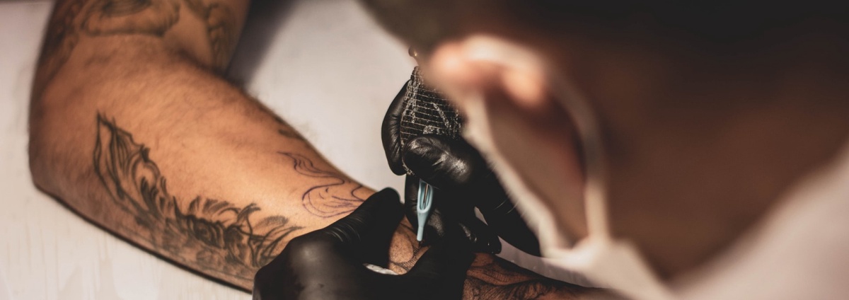 Navigating Tattoo Removal Costs in NYC: Tips and Insights