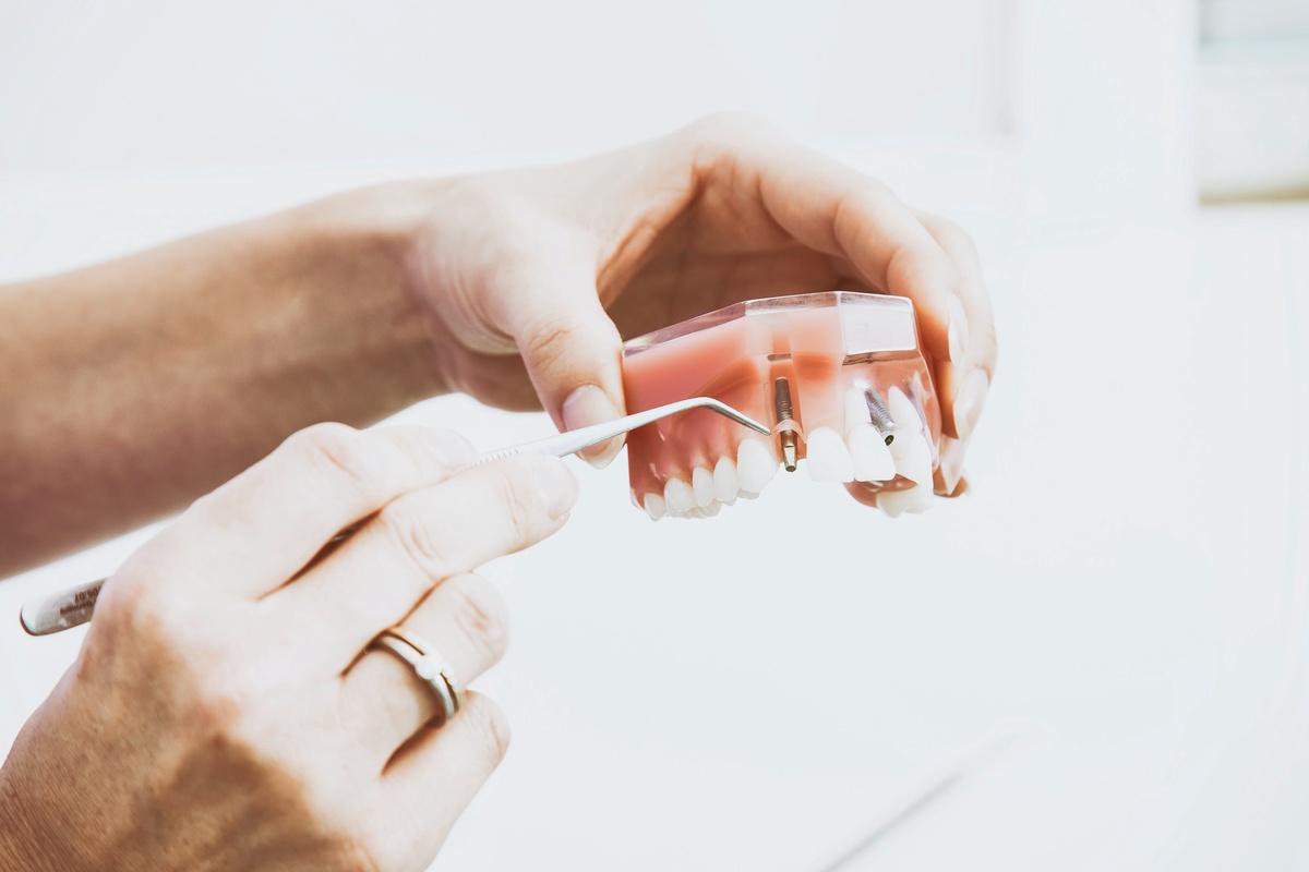 The Denture Implant Journey: Here's What's in Store