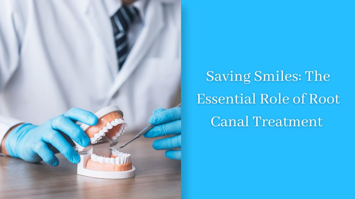 Saving Smiles: The Essential Role of Root Canal Treatment