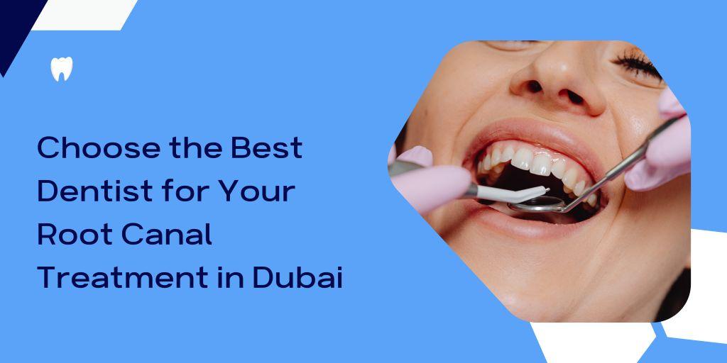 How to Choose the Best Dentist for Your Root Canal Treatment in Dubai