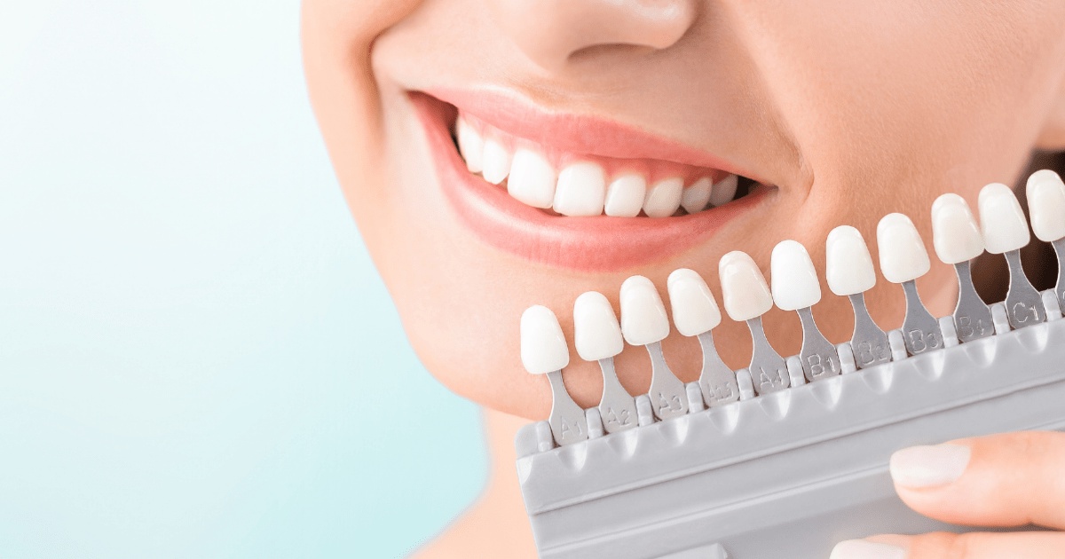 Teeth Whitening and Oral Health: Understanding the Relationship between Whitening and Dental Wellness