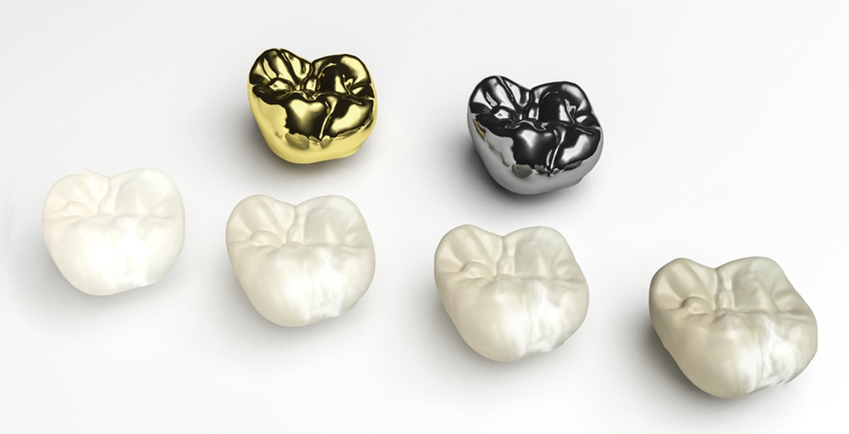 Restore Your Dental Health Through Teeth Crown Services