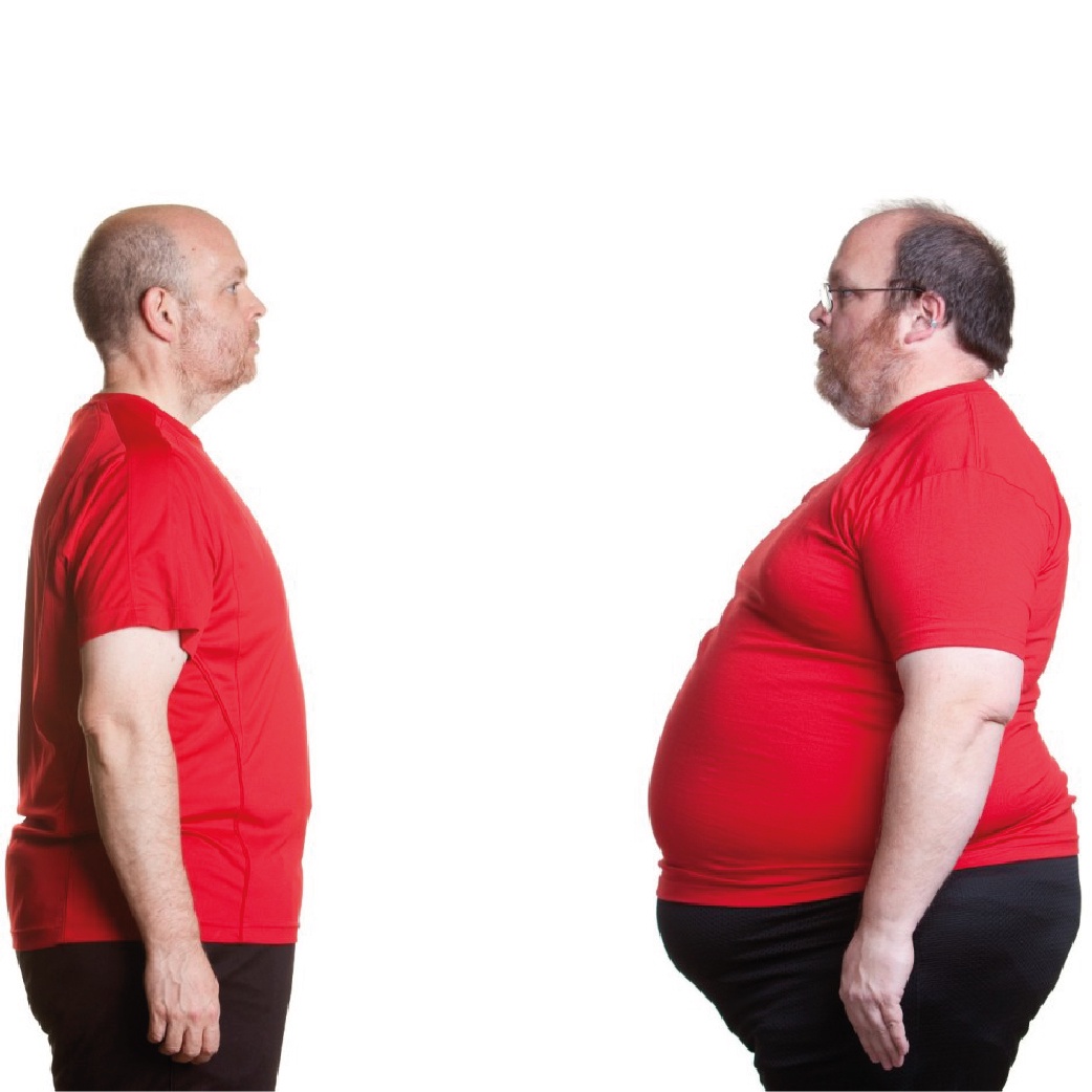 Our Gastric Balloon Method for Weight Loss in Turkey