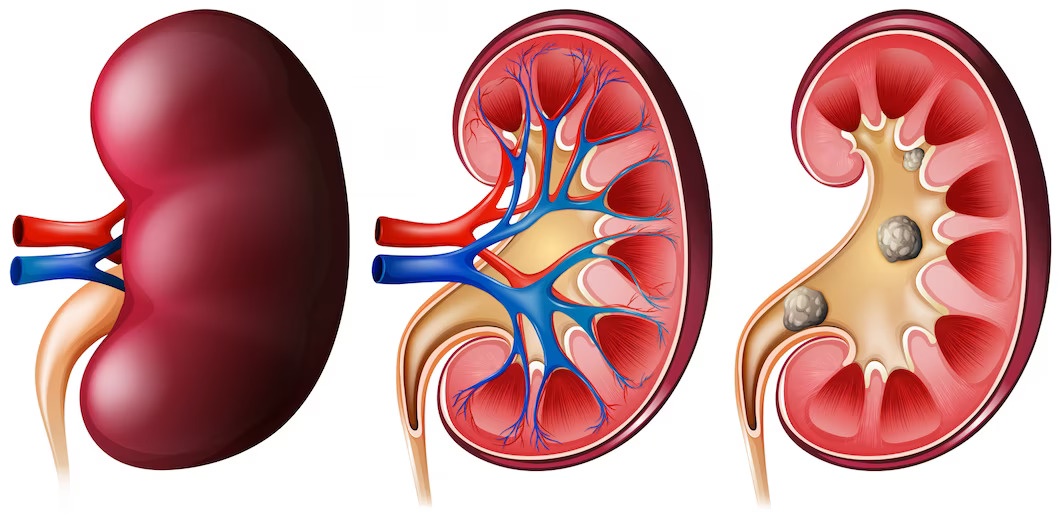 When to Worry About Creatinine Levels: Understanding Low Creatinine and Its Causes