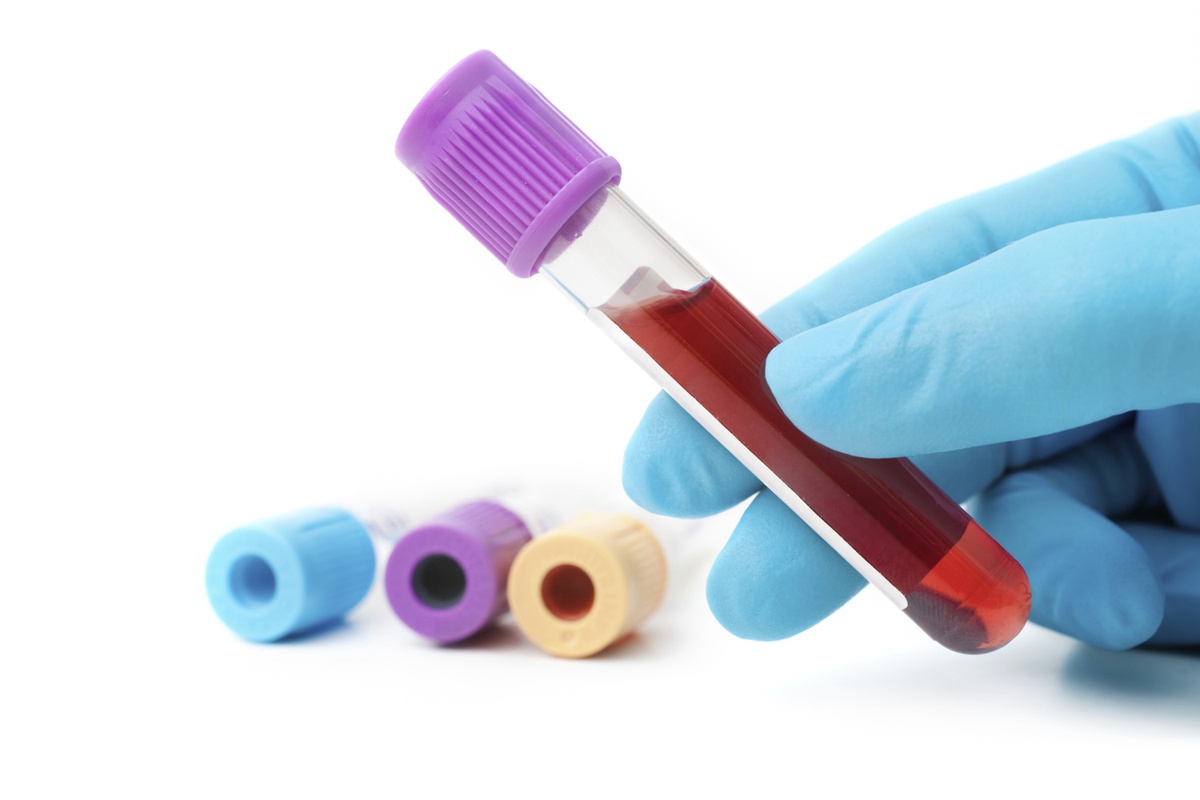 Blood Tests at Home: Convenience and Accessibility for Improved Healthcare