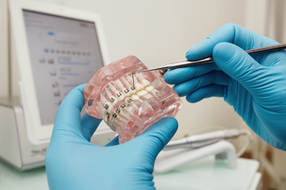 Essential Factors to Consider Before Deciding on a Dental Bridge