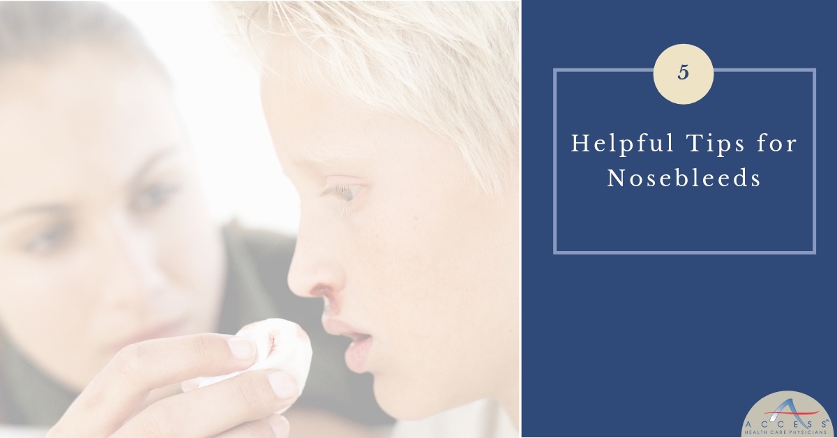 Here are the steps on how to stop a nosebleed: