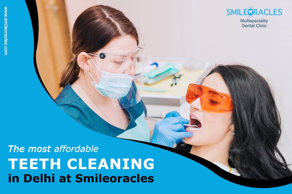 The Most Affordable Teeth Cleaning in Delhi