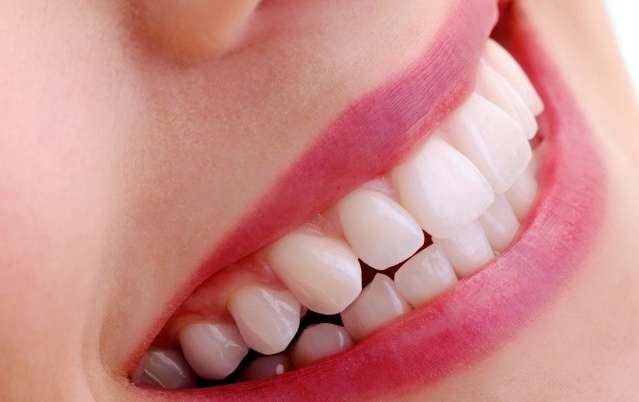 Enhancing Your Smile with Composite Bonding in North London
