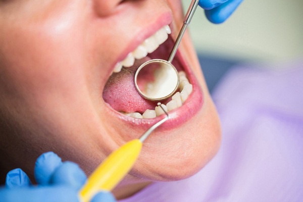 How to Prevent Recurring Bleeding Gums: Tips and Strategies