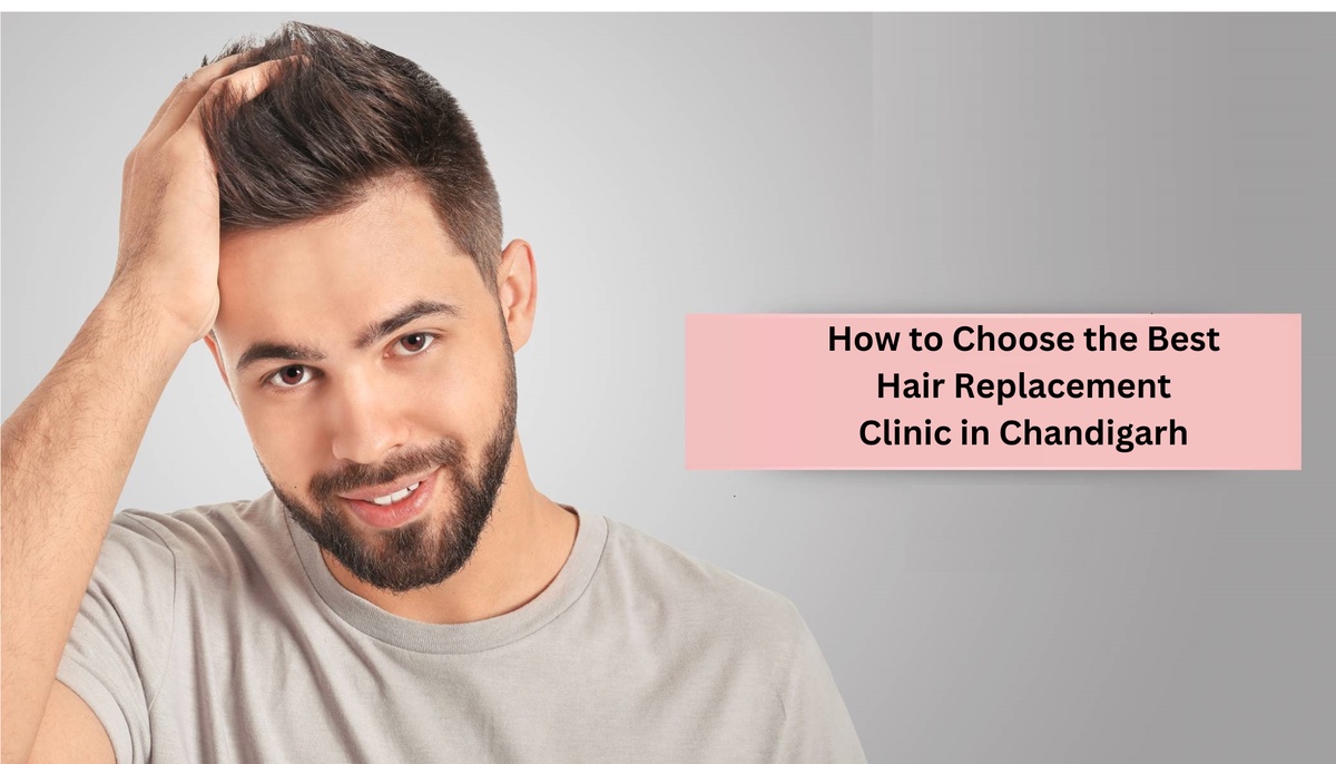 How to Choose the Best Hair Replacement Clinic in Chandigarh