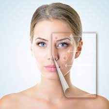 Is Facial Filler Safe? Exploring the Benefits and Considerations