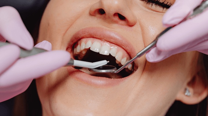 Understanding Common Dental Emergencies and How to Handle Them