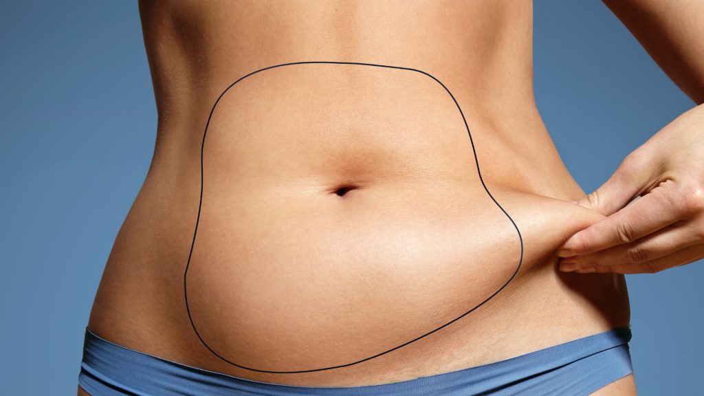 How to Maximize the Benefits of Liposuction Treatment