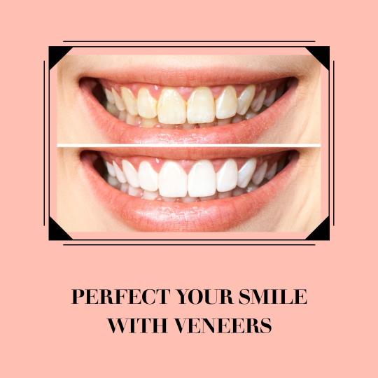 Wear Veneers for a Stunning Smile in Christchurch