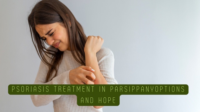 Psoriasis Treatment in Parsippany: Options and Hope