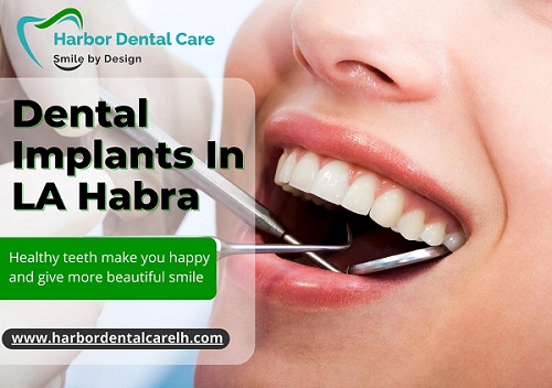 Concerns for Dental Implants Replace Several Missing Teeth in La Habra