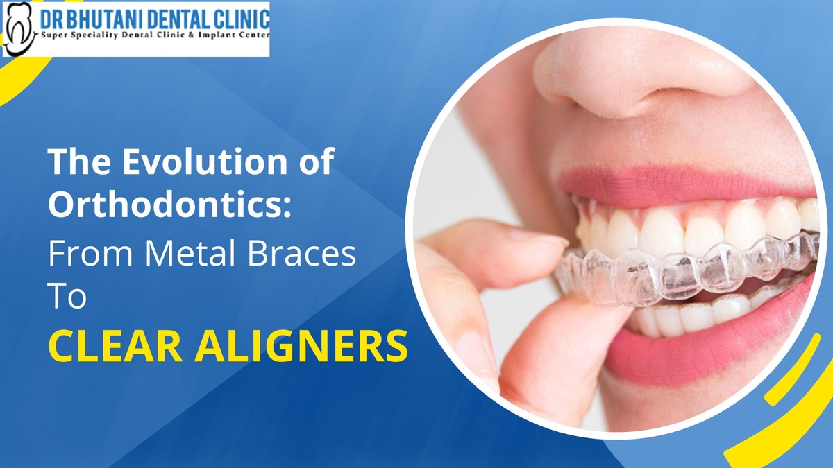The Evolution of Orthodontics: From Metal Braces to Clear Aligners