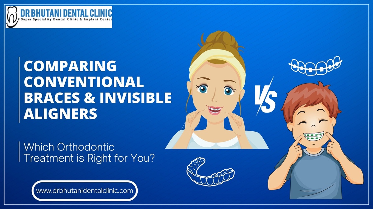 Comparing Conventional Braces & Invisible Aligners: Which Orthodontic Treatment is right for you?