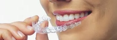 Learn Everything about Invisalign and what is the Cost of Invisalign?
