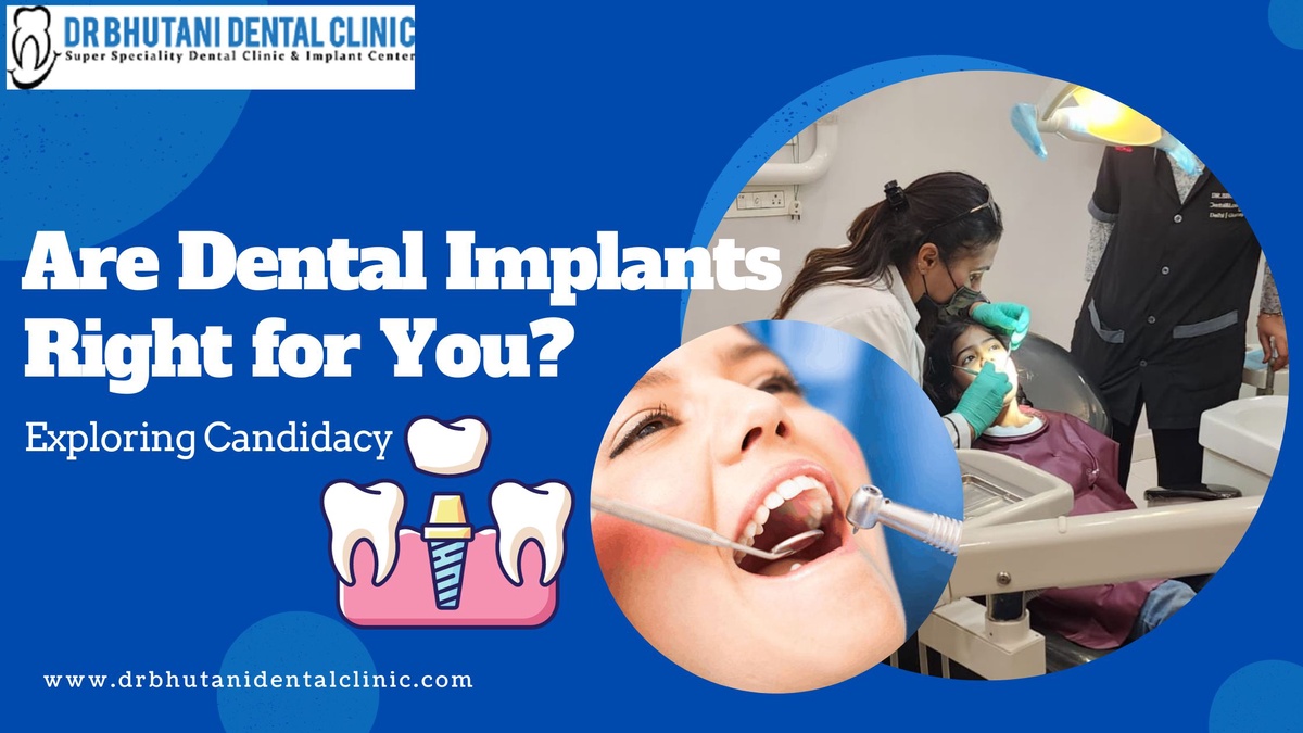 Are Dental Implants Right for You? Exploring Candidacy