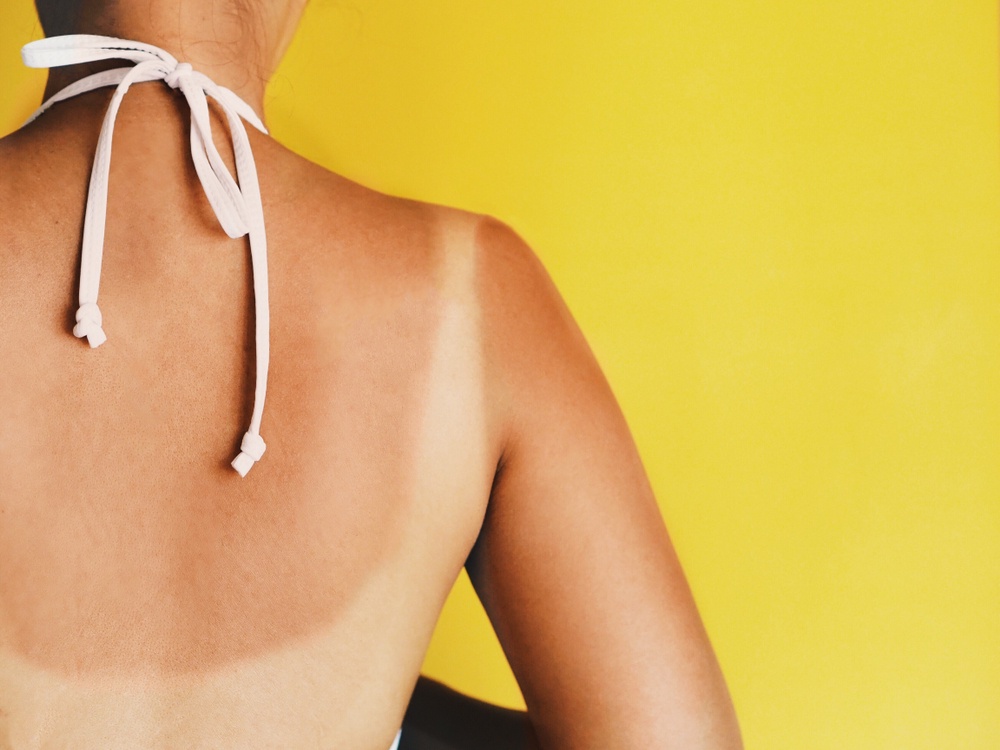 Expert Reveals How to Get the TikTok Tan Lines Trend with the Sun