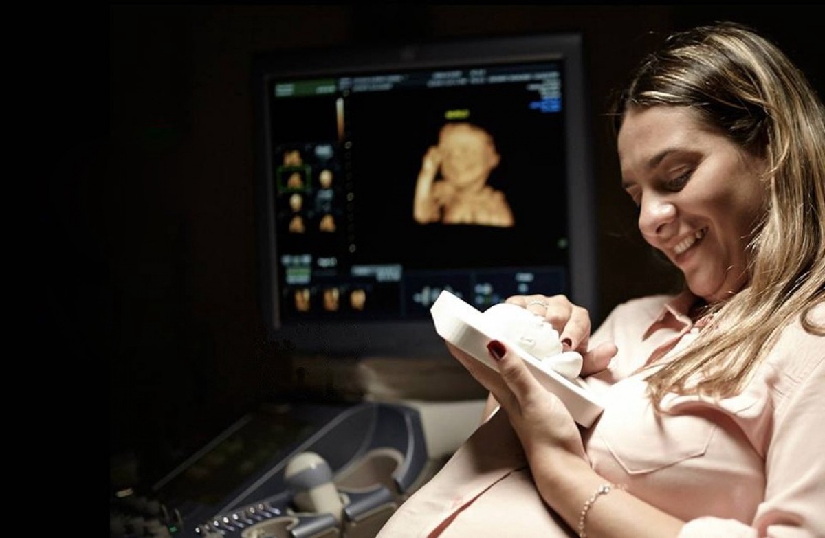 The Benefits of 3D and 4D Ultrasound