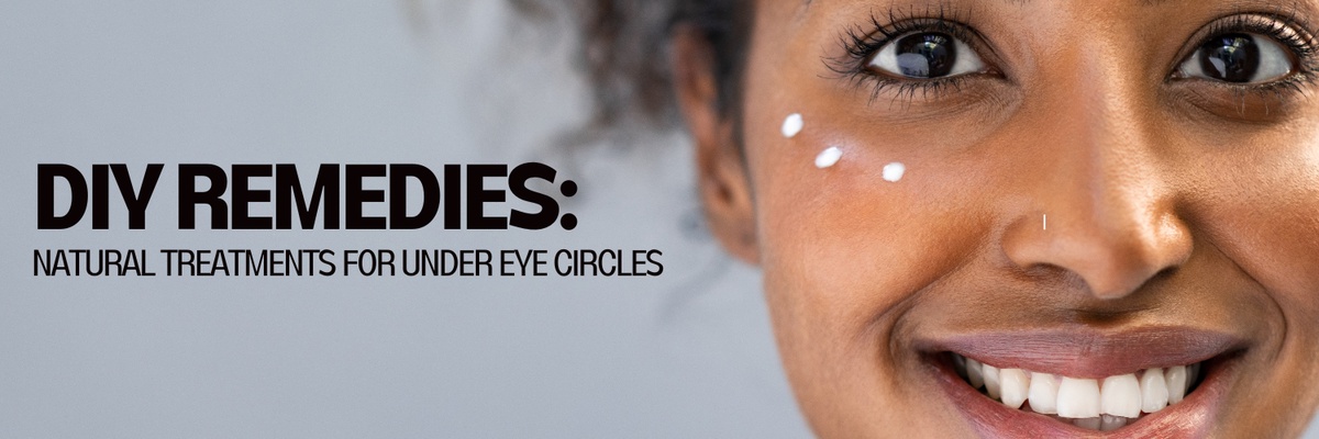 DIY Remedies: Natural Treatments for Under Eye Circles