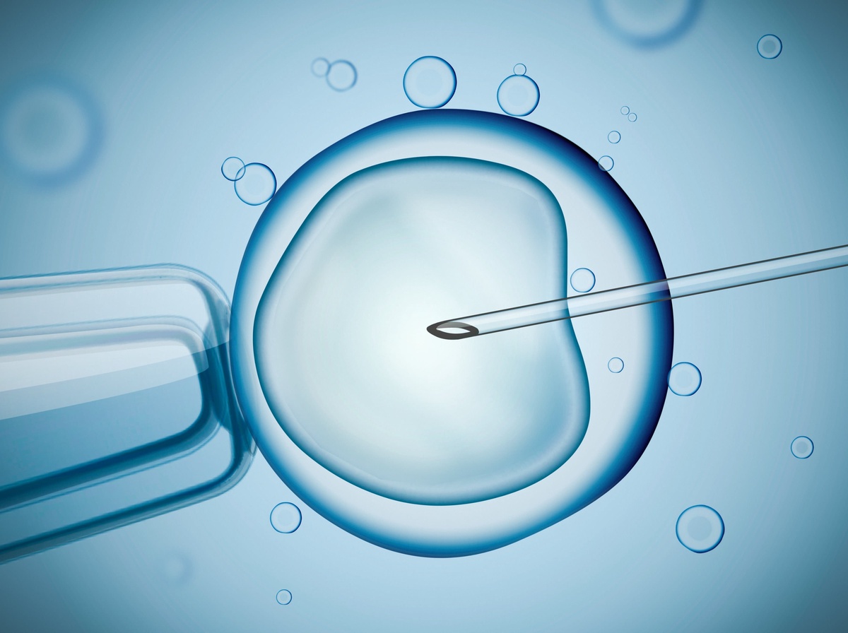 IVF is the shortened version of In Vitro Fertilisation