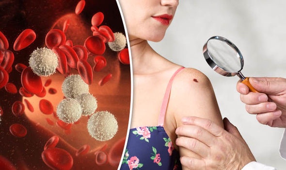 Lymphoma Rash: When A Blood Cancer Attacks The Skin