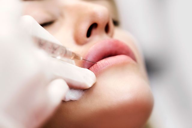 Botox Lip Flip In Dubai and Beyond