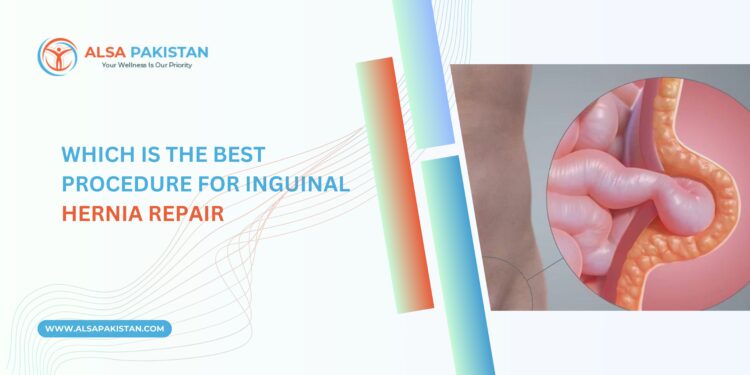 Which Is the Best Procedure for Inguinal Hernia Repair?